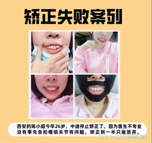 武汉28岁矫正牙齿还来得及吗?我的经历和答案