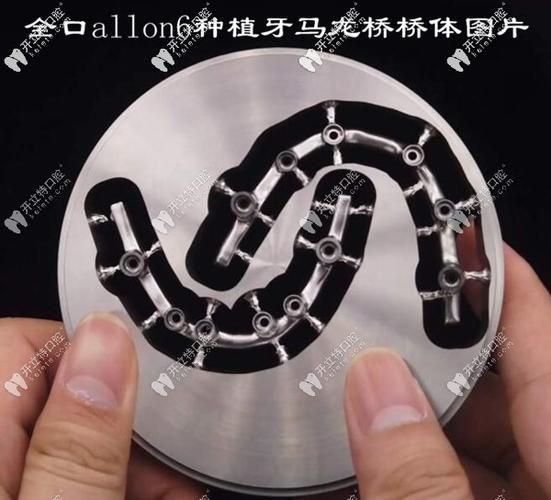 武汉深圳半口All-on-4种植牙医院怎么选?地址与避坑指南