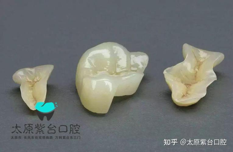 武汉口腔检查反馈单看不懂?3步教你秒读