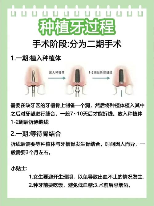 种牙是真牙吗还是假牙_种牙是怎么种的_什么是种牙如何种