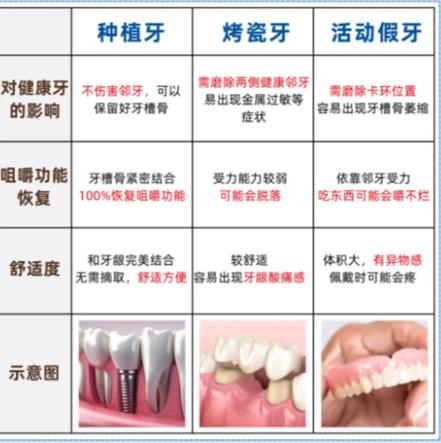 武汉赤峰种牙别乱选 公立三甲医院才靠谱