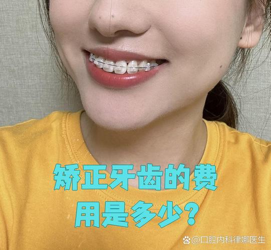 武汉纠正牙型费用全解析:矫正牙齿一般要多少钱