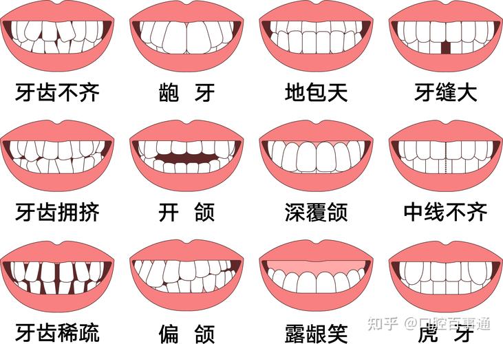 武汉25岁矫正牙齿还来得及吗真实经历分享