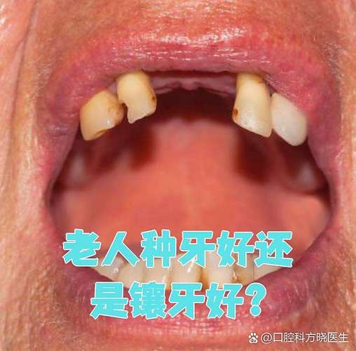 武汉74岁老人种牙晚不晚？医生揭秘高龄种植的真实风险与收益