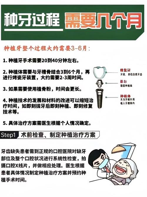 武汉半口种植牙能用多久?医生技术好能管20年