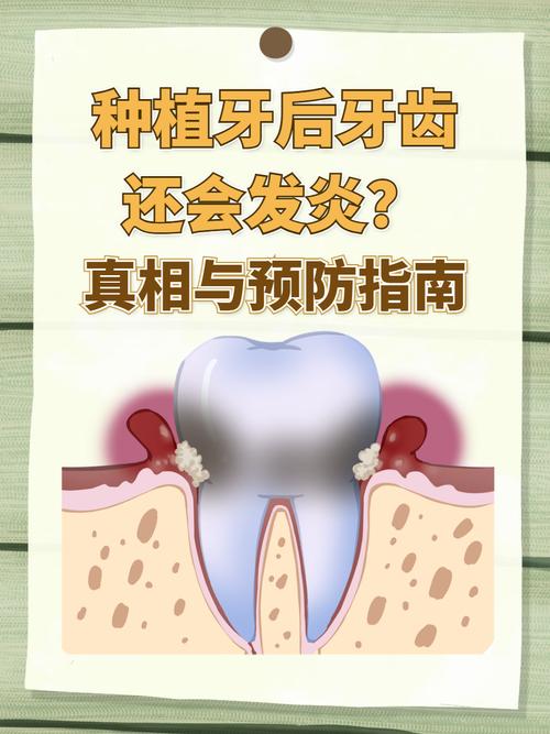 武汉种植牙严重松动发炎,什么情况需要拔除?