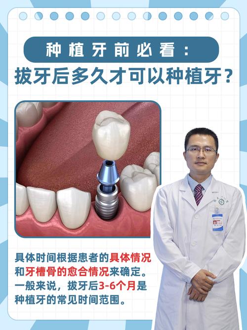 拔牙种植牙医保可以报销吗_拔牙种植牙需要多久时间_拔种植牙吗