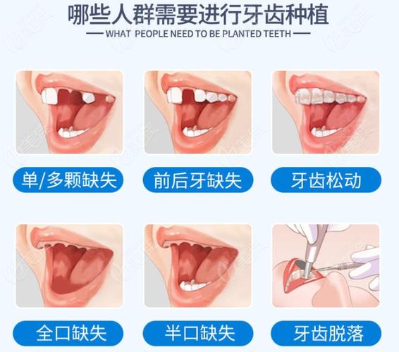武汉保定口腔医院收费多少钱?看牙项目全解析