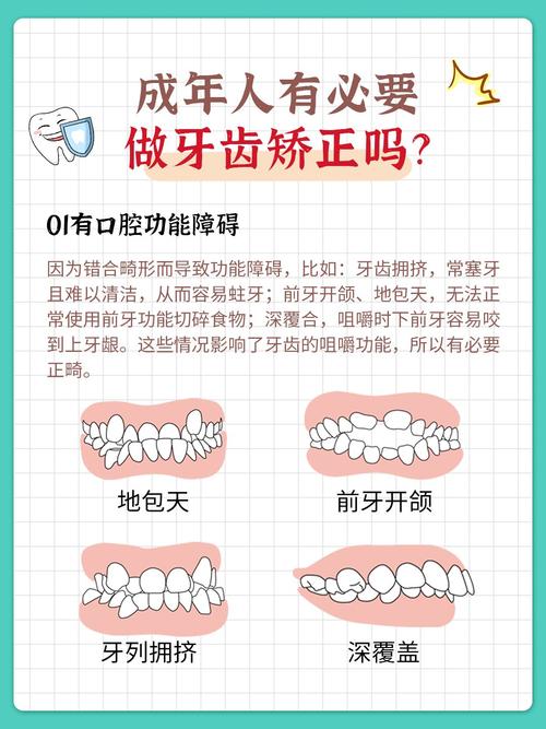 武汉成年人牙齿矫正适合吗?30+做也不晚,先看这几点
