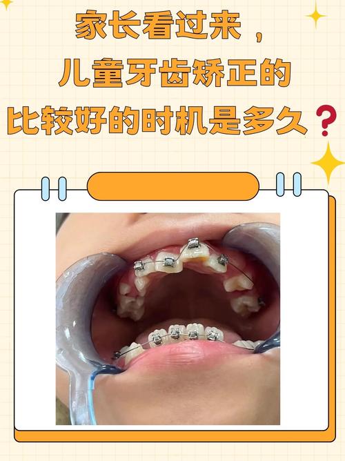 武汉8岁做牙齿矫正不早!关键看这几种情况