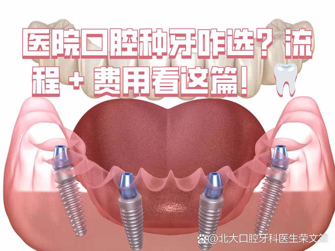 武汉深圳连锁牙科种牙贵不贵？值不值得选？