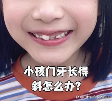 武汉深圳孩子换牙门牙乱长怎么办?专业干预攻略
