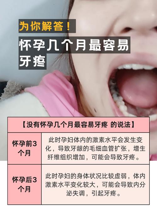 武汉经期孕期感冒期,期间可以种牙吗?看身体状态定