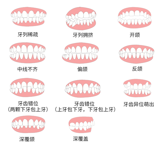 武汉30岁做牙齿矫正到底值不值 利与弊全分析