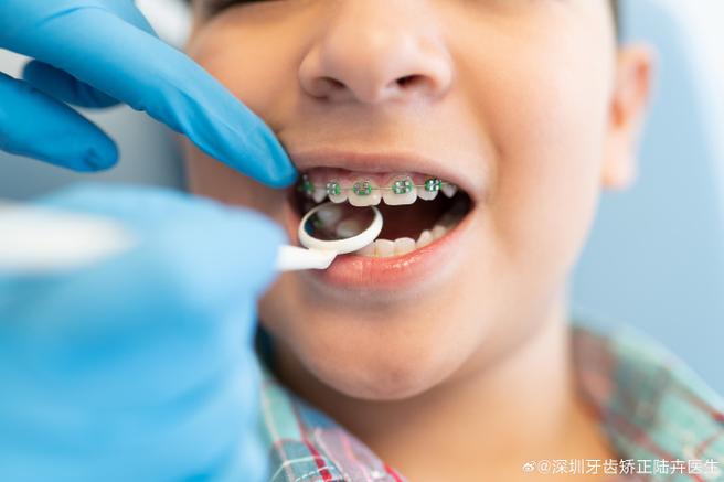 武汉8岁孩子门牙龅牙矫正方法 儿童早期干预怎么做