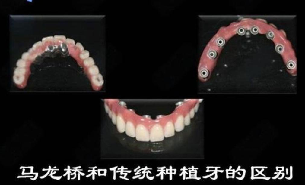 武汉大同种牙哪里好 选公立还是私立更靠谱