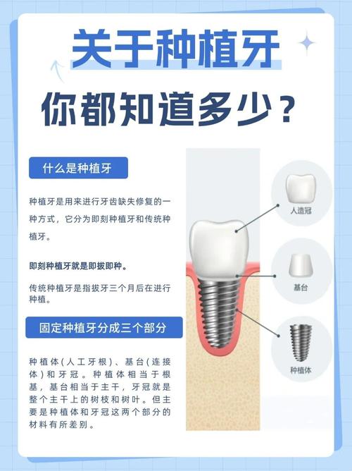武汉4颗牙一起种到底靠不靠谱 种植医生一次性讲清楚
