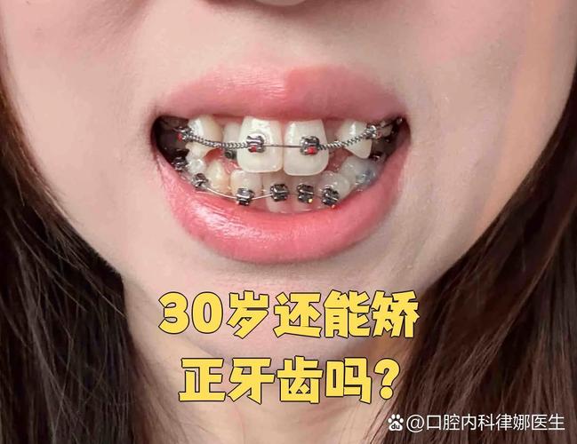 武汉成年人也能做矫正 牙齿年龄限制真相大揭秘