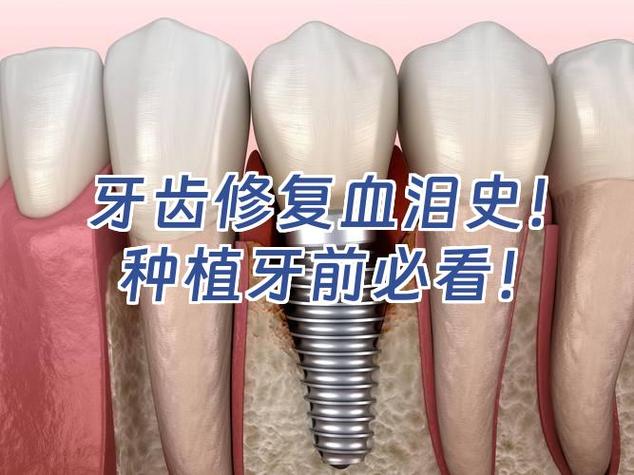 武汉种植牙失败了怎么办 修复费用要多少才合理