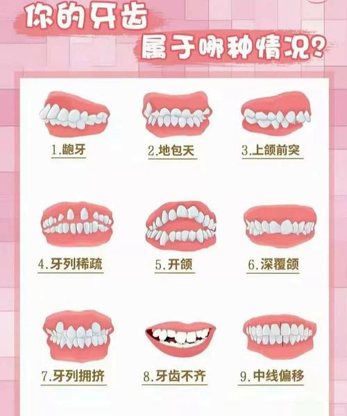 武汉孩子几岁矫正牙齿最好 成人还能矫正吗