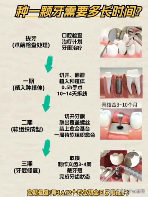 武汉种牙前做CT是必须的吗 2026种牙CT检查费用全解析