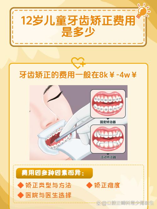 武汉12岁矫正牙齿要多少钱?医生揭秘各阶段费用明细