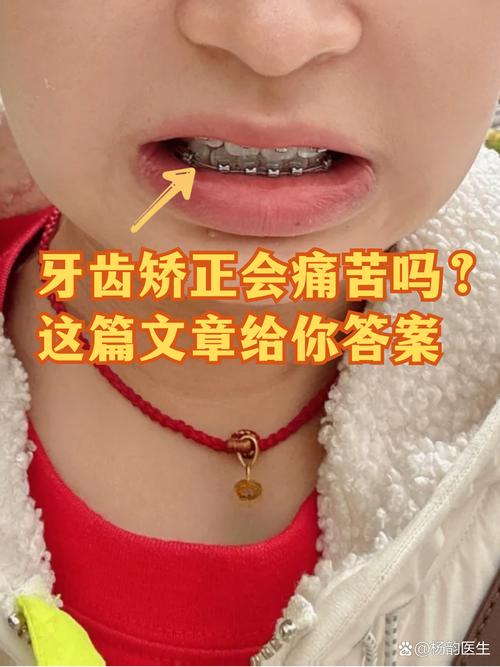 武汉19岁做牙齿矫正晚不晚 过来人告诉你真实经历
