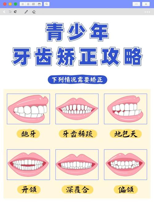 武汉15岁牙齿不齐别慌!抓住矫正黄金期,这些方法快收藏