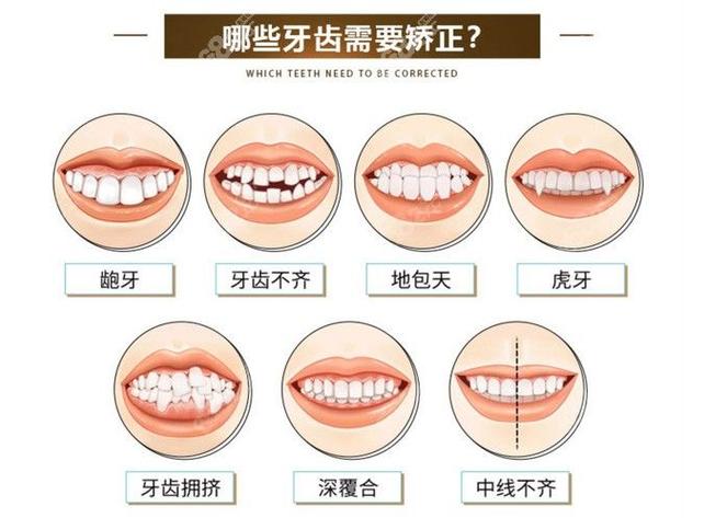 武汉38岁矫正牙齿晚不晚 别让年龄成为你犹豫的借口