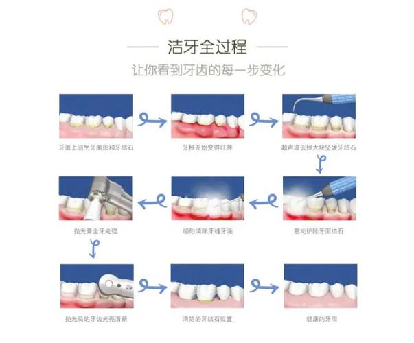 武汉深圳宝安隐适美正品认证医院怎么选？