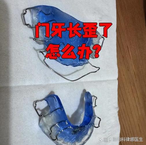 武汉牙齿长歪了怎么矫正?多少钱能搞定?