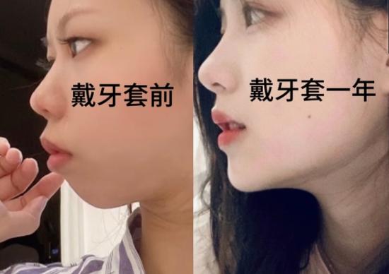 武汉郴州做牙齿矫正哪家好？看完这篇不踩坑