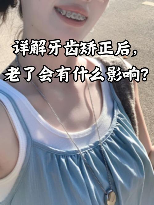 武汉40岁还能矫正牙齿吗?看完这篇文章让你了解40岁牙齿矫正的真相