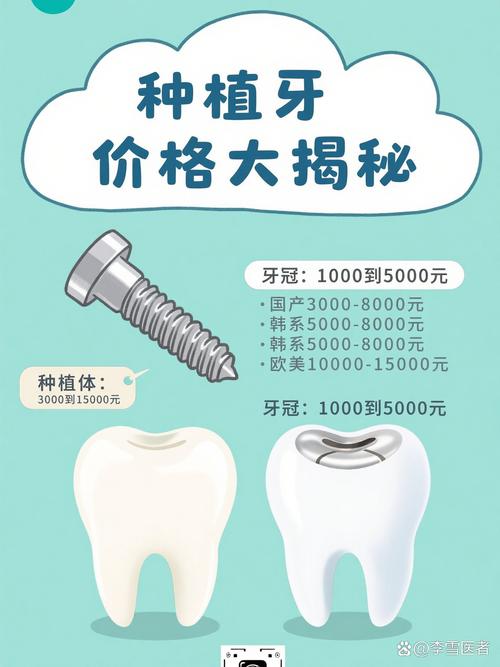 武汉奥齿泰种牙贵不贵?一颗的价格究竟是多少?看完这篇就知道!