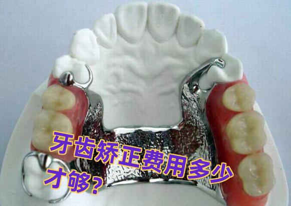 武汉长沙矫正牙齿费用一览:从几千到几万差在哪