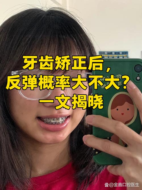 武汉19岁做牙齿矫正晚不晚 过来人告诉你真实经历