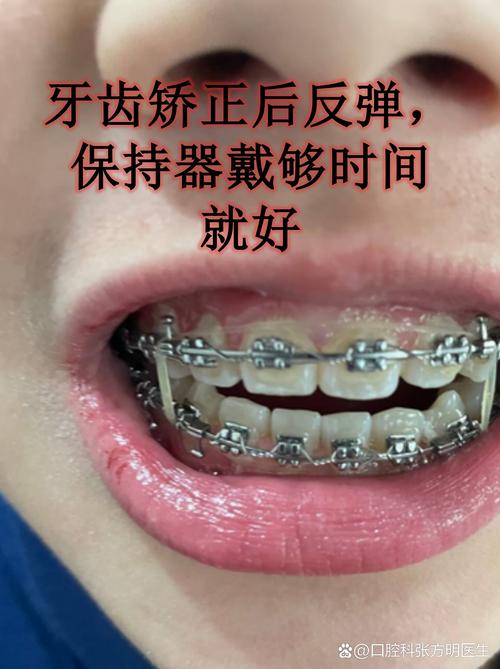 牙齿矫正还能做磁共振吗_牙齿矫正还能做ct吗_19岁还能做牙齿矫正