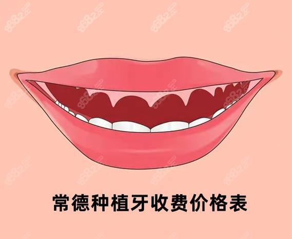 武汉常德半口种植牙费用2026大概多少钱?真实价格参考